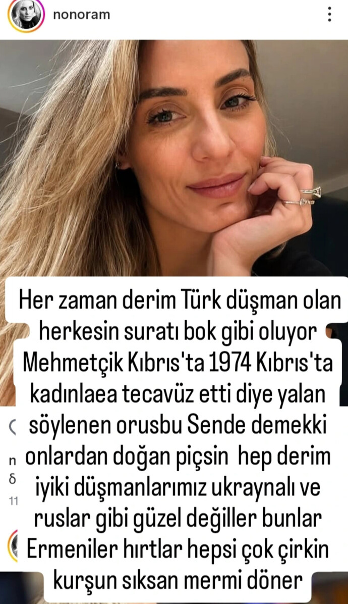 Avrupa Parlamentosunda Mehmetçik hakkında atılan iftira ve bu kararı aldıran kadın hakkında ne düşünüyorsunuz?