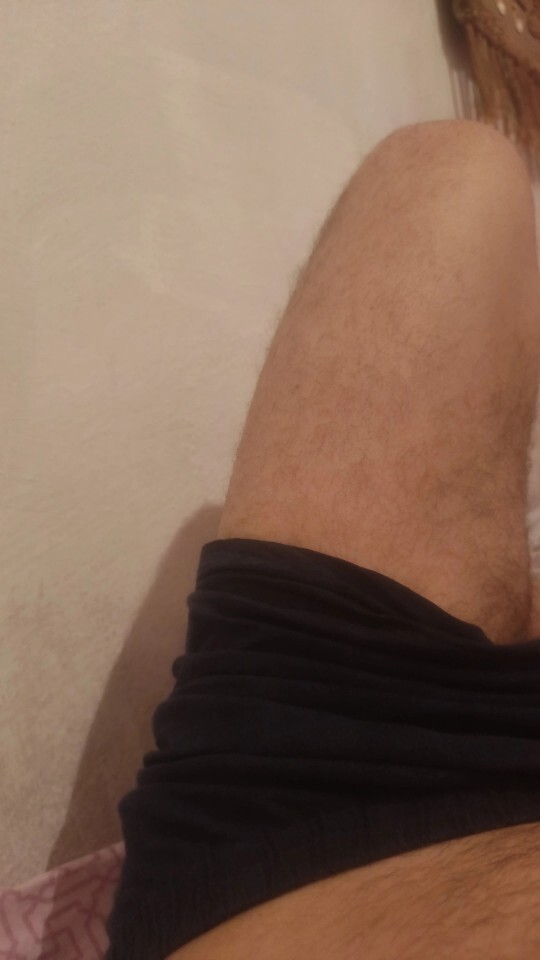 Bacağımda kıl yoğunluğu normal mi, bacak kıl dengesi nasıl olmalı?