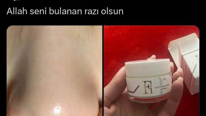 Allah seni bulandan razı olsun dediğiniz bir krem var mı?