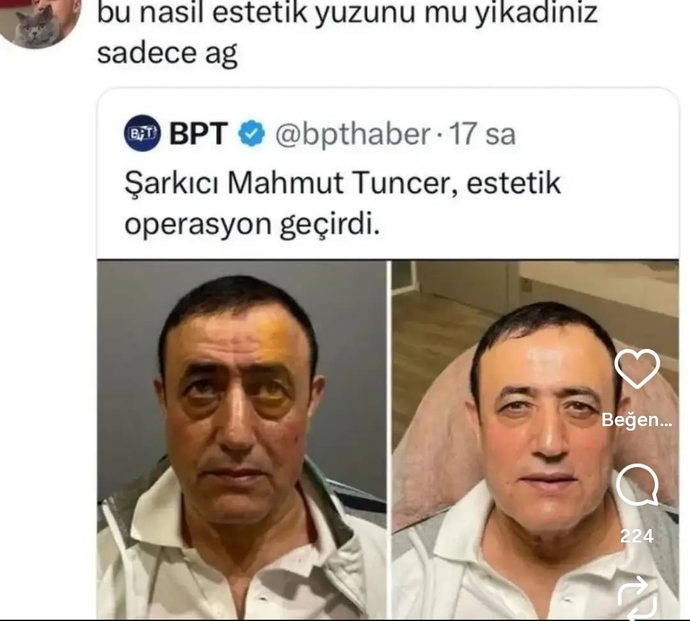 Hiç estetik yaptırdınız mı?