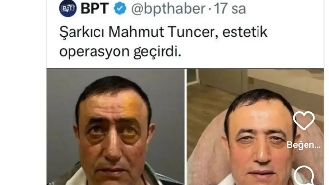 Hiç estetik yaptırdınız mı?