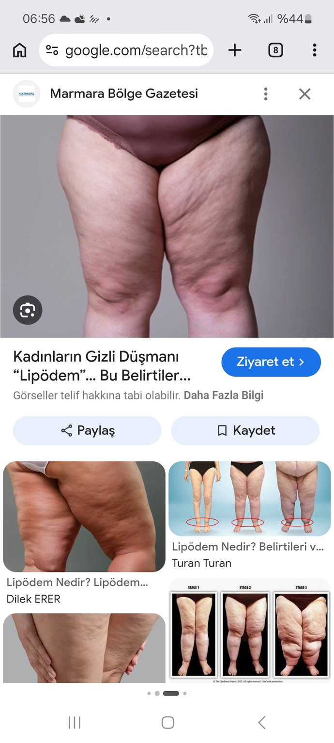Bacaklarımı sarkmadan nasıl zayıflatrm?