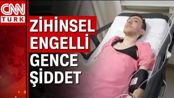 Toplumu Genel Olarak Beğeniyormusunuz? Ben Şahsen beğenmiyorum Özürlü vatandaşı Dövecek Kadar İnsanlıktan Çıkmış Vaziyette?