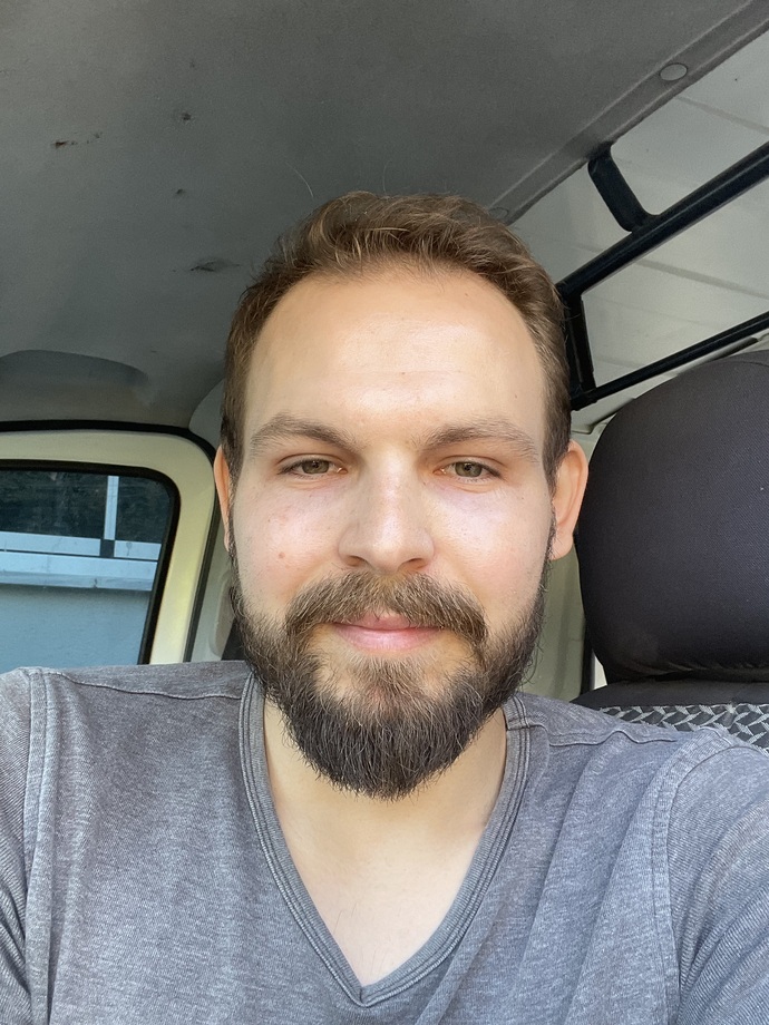 Saç ektirsem nasıl olur?
