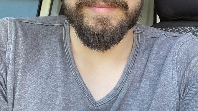 Saç ektirsem nasıl olur?