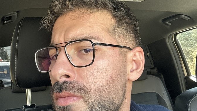 Şu yanağımdaki izler pis duruyor mu nasıl geçer yav🫤?