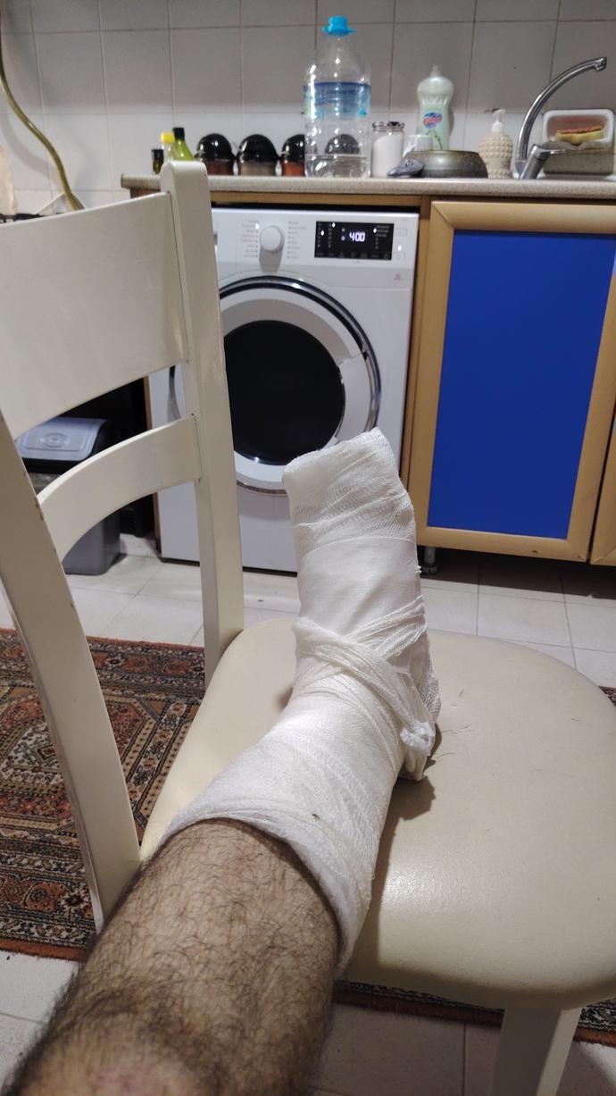 Küçük bir kaza yüzünden tüm yazı evde tek başıma geçiriyorum, sizde yaz tatili nasıl gidiyor?