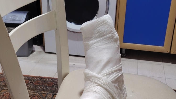 Küçük bir kaza yüzünden tüm yazı evde tek başıma geçiriyorum, sizde yaz tatili nasıl gidiyor?