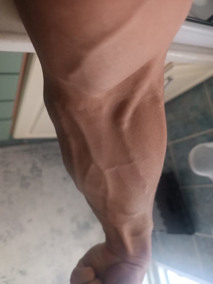 Teninizde damarlar ne kadar belli oluyor?