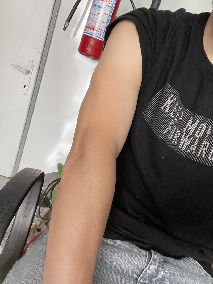 Kal kalınlığı iyi mi?