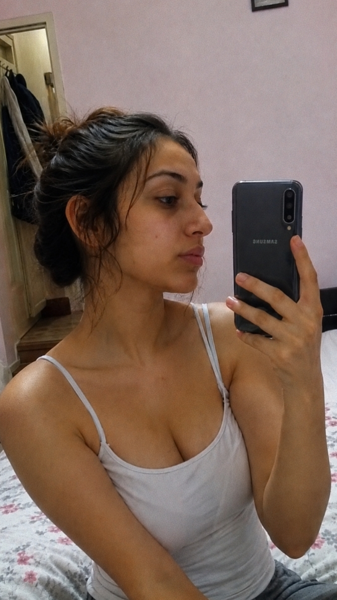 Burnum çok mu çirkin? Estetik yaptırmalı mıyım?