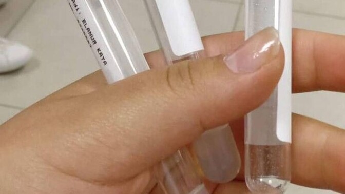 Damarınız kolay bulunur mu?
