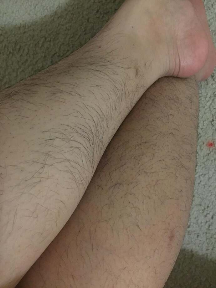 3 aydır kıllarımı almıyorum ama şort ve etek giyiyorum, bu kadar rahat olmak normal mi?