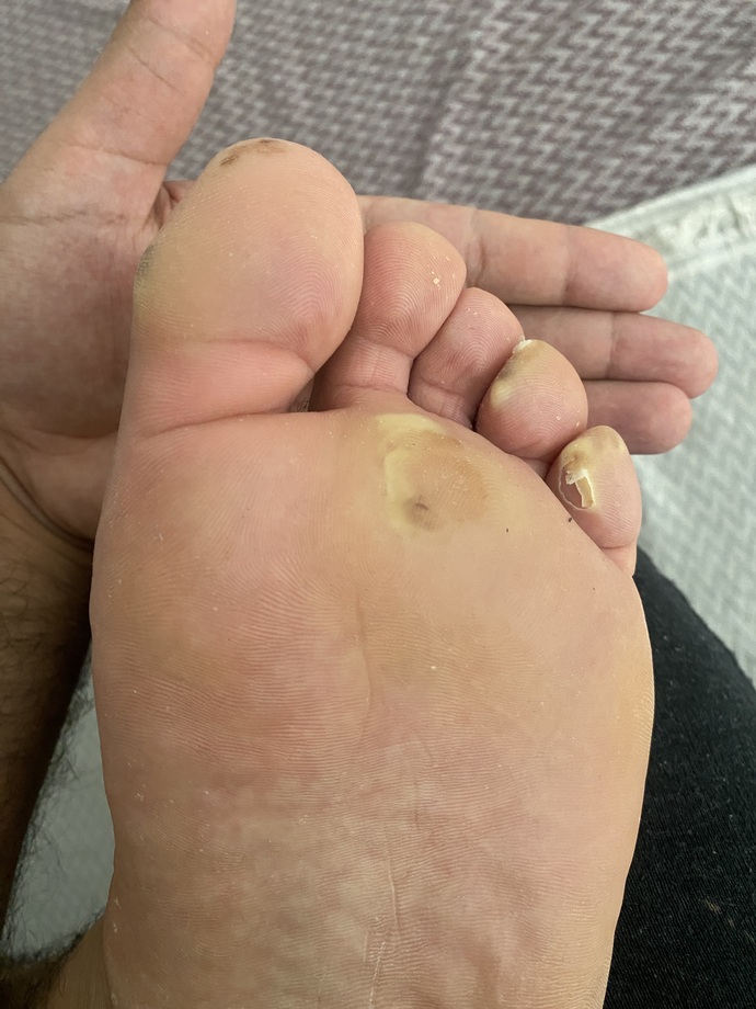Ayaklarınıza kara sular indi mi?