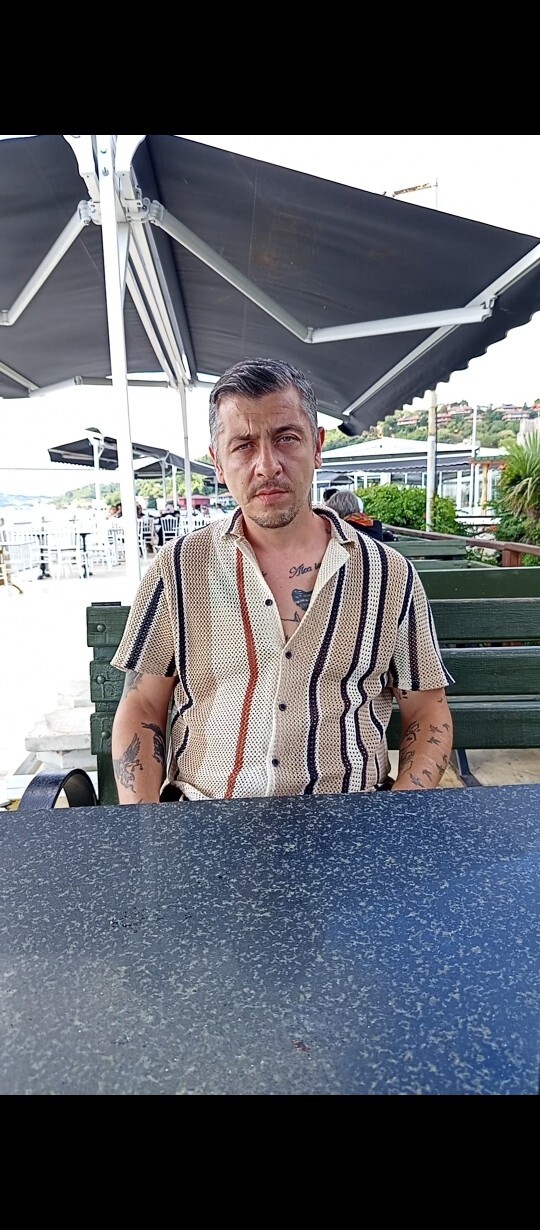 Yüzümdeki yaralar kötü duruyor mu?