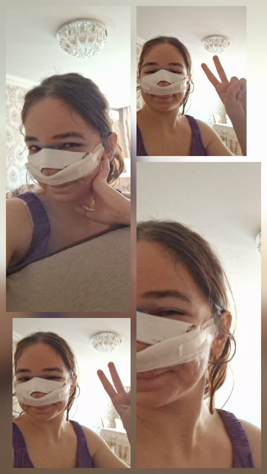 Ödem ne zaman geçer, 3 günde ödem atmak normal mi?