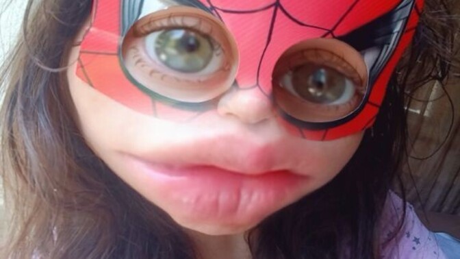 Derdinize derman olmaya geldim, spiderman olarak spiderman sever misiniz?