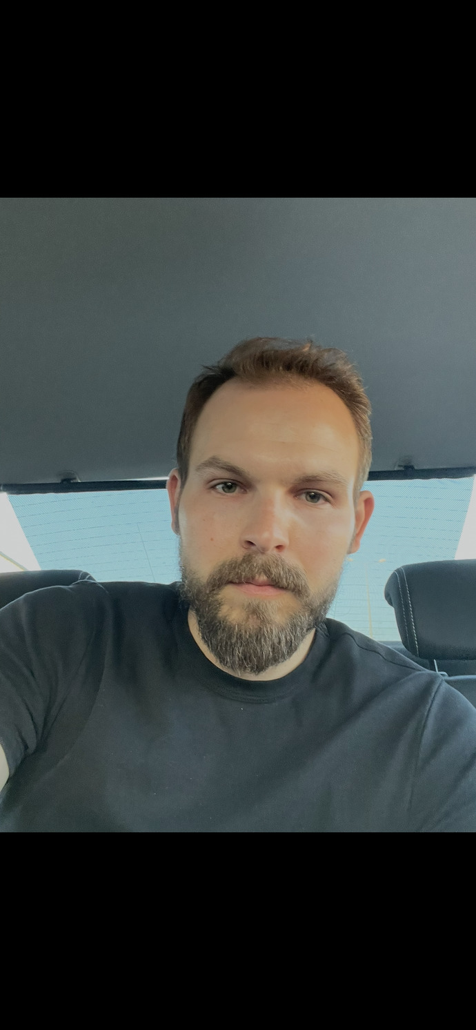 Saç dökülmesi çok büyük bir sorun mu?