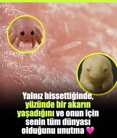 Yüzünüzde yaşayan akarın tüm dünyası aslında siz olsanız ne hissederdiniz?