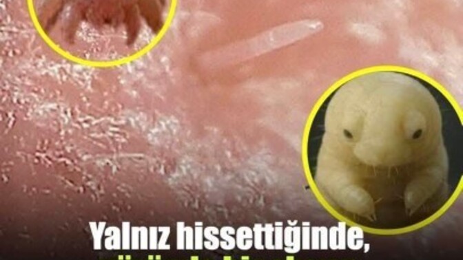 Yüzünüzde yaşayan akarın tüm dünyası aslında siz olsanız ne hissederdiniz?