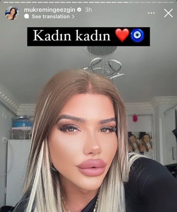 Sevgilinizin estetik yaptırmasına müdahale eder misiniz?