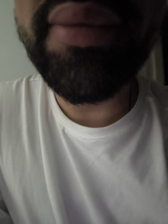 Dolgun dudak erkeklerde itici mi?
