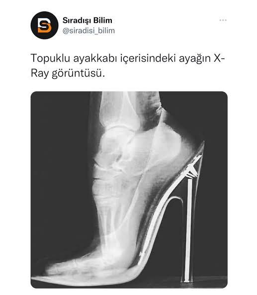 Sürekli topuklu ayakkabı giyenler bir tebriği hak ediyorlar mı?