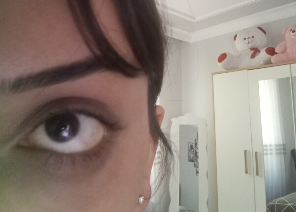 Sigara falan kullanmiyorum ama göz çevrem aşırı koyu nasıl kurtulurum bundan?