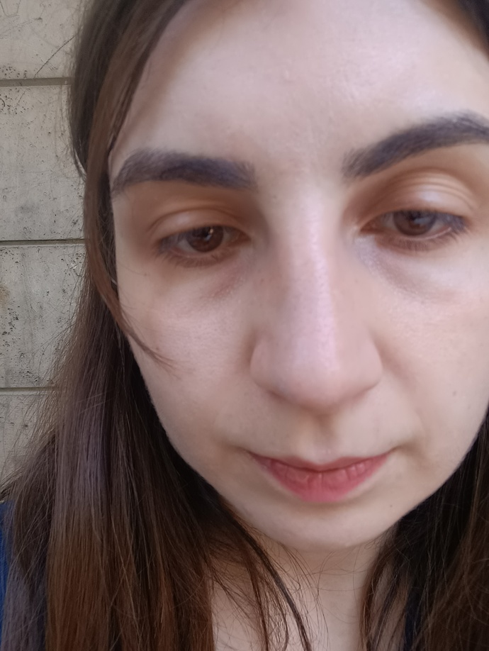 Sigara falan kullanmiyorum ama göz çevrem aşırı koyu nasıl kurtulurum bundan?