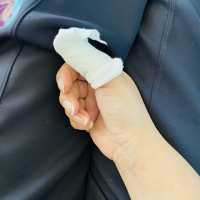 Elimi kestim ama kalbim daha çok acıyor hangisine pansuman şart?