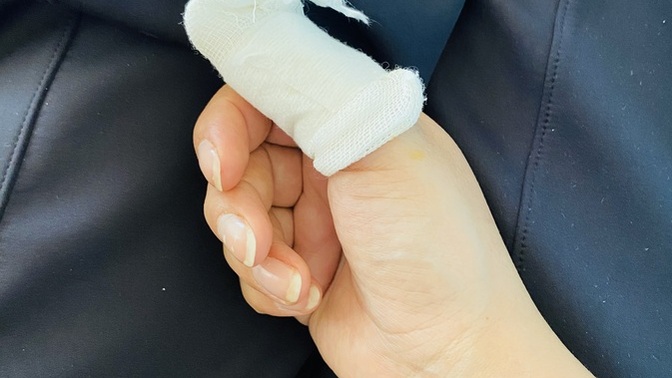Elimi kestim ama kalbim daha çok acıyor hangisine pansuman şart?