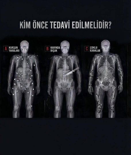 Sizce önce kimin tedavi edilmesi gerek?