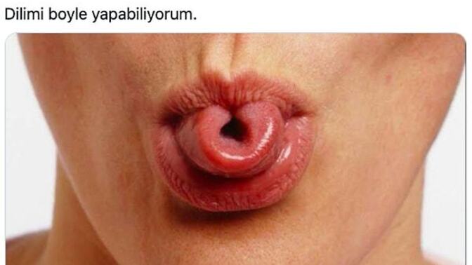 En gereksiz özelliğin nedir?
