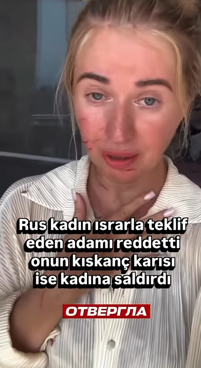 Kocasını ayartıyor diye türk kadin rus kadini dovmus ne dusunuyorsunuz?