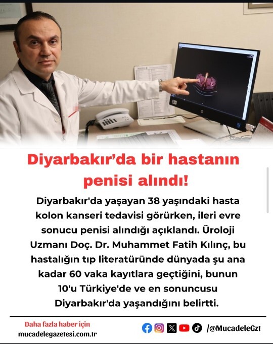 Arkadaşlar aklım almıyor, böyle bir şey gerçekten olabilir mi?