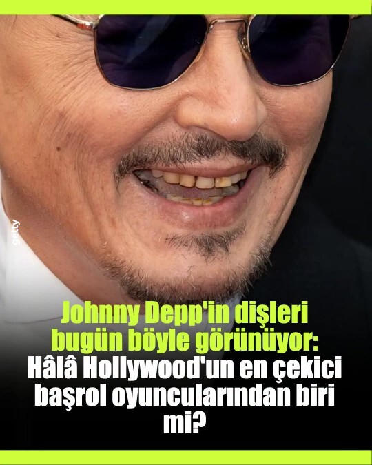 Johnny Depp in dişlerinin görüntüsü onun Hollywoodun en çekici erkeği yapmaktan alıkoyuyor mu?
