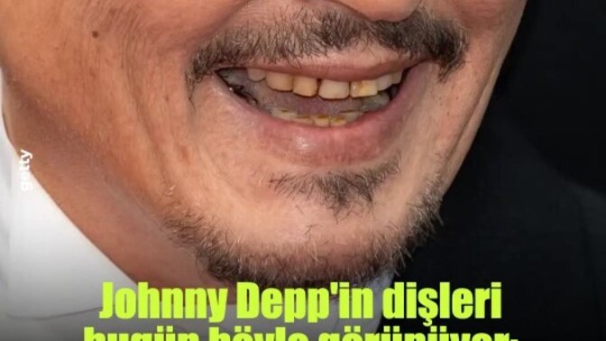 Johnny Depp in dişlerinin görüntüsü onun Hollywoodun en çekici erkeği yapmaktan alıkoyuyor mu?