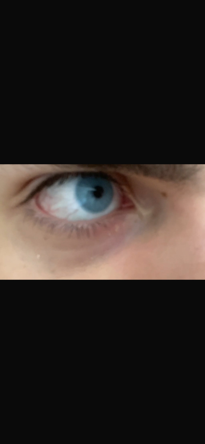 Sizce daha iyi duran hangisi, kendi göz rengim mi yoksa mavi lens mi?