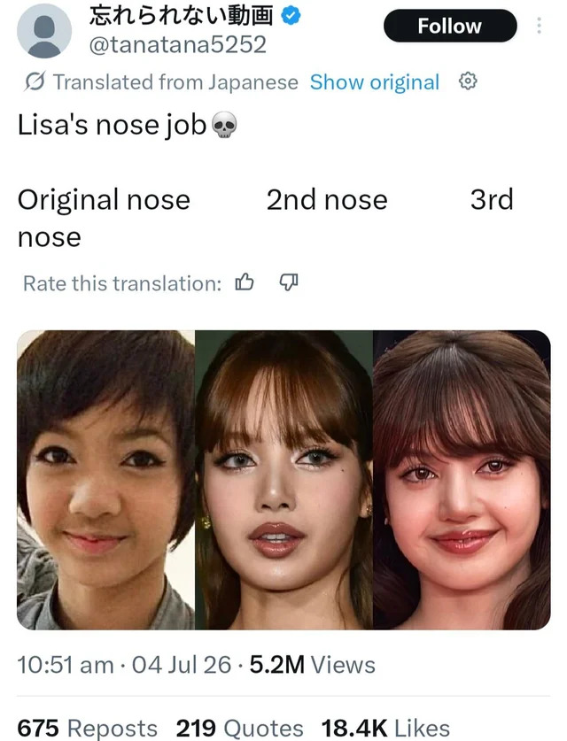 Biz neden Lisa gibi şanslı doğmadık?