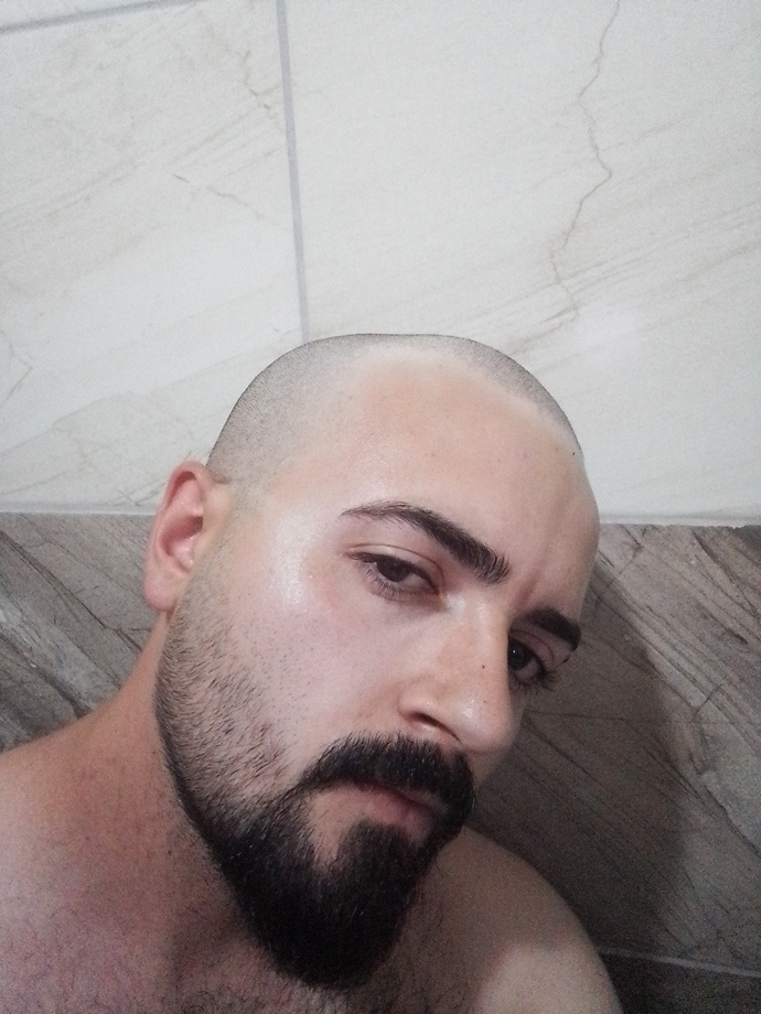 Saçlarımı dökülüyor diye kısa kestirdim, sence çok mu kötü duruyor?