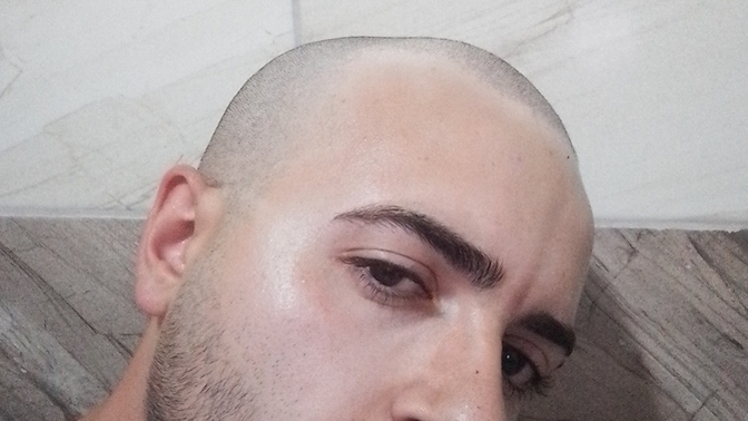 Saçlarımı dökülüyor diye kısa kestirdim, sence çok mu kötü duruyor?