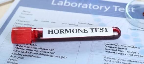 Hormonal sorununuz var mı?