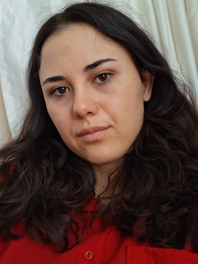 Yüzümü hiç güzel bulmuyorum, gözaltlarım yorgun ve cansız görünüyor, sizce normal mi?