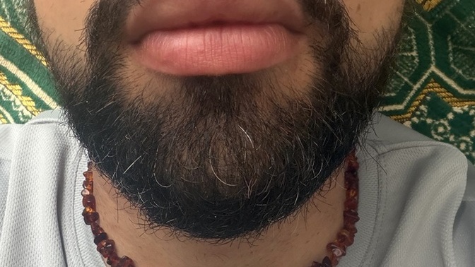 Erkekte dolgun dudak çekici mi sizce kızlar?