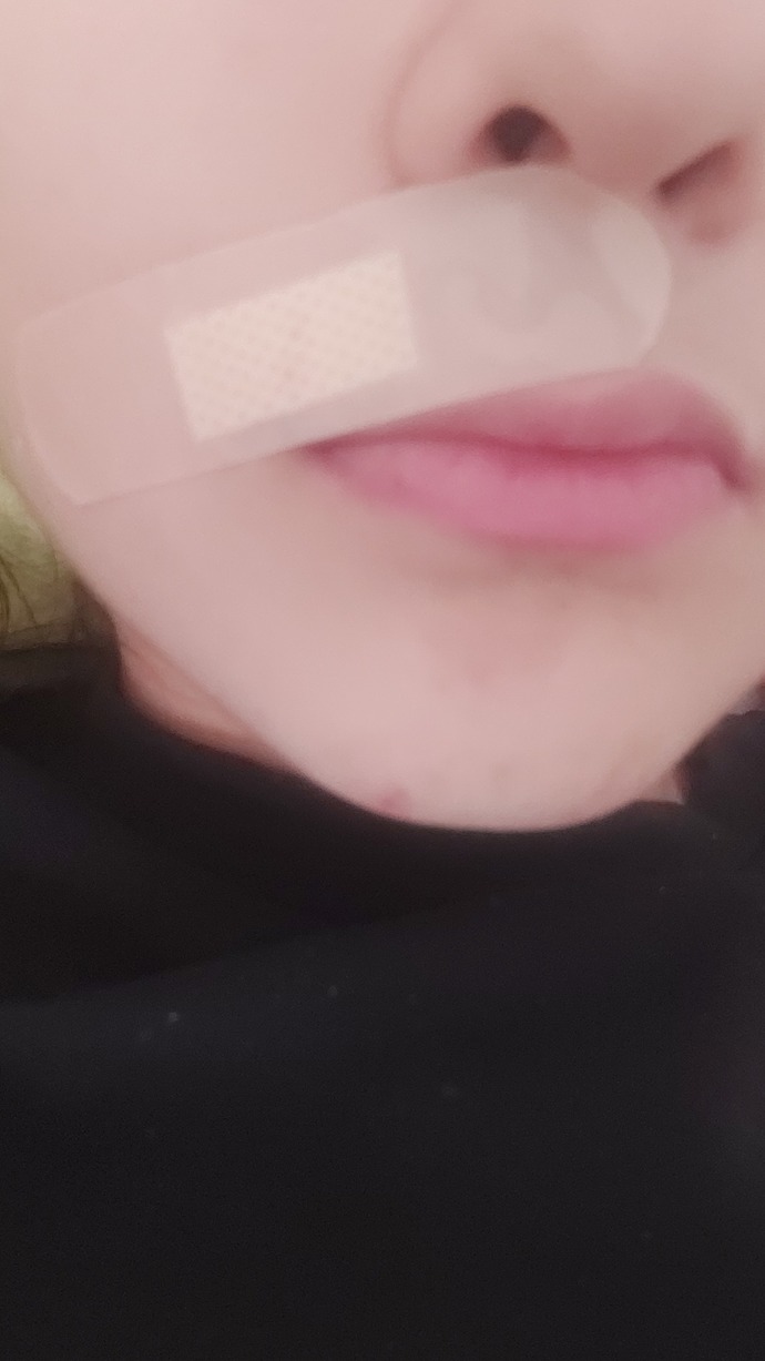 Dudağımın üstündeki tüyleri usturayla alamaya çalışırken yüzümü kestim ne yapmalıyım?