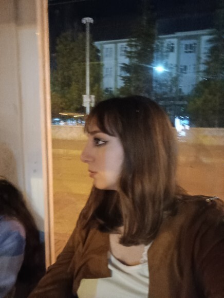 Kızlar sizce estetik mi yoksa dolgu mu yaptırsam?