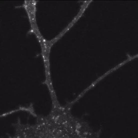 Alzheimer, Parkinson ve beyin hasarları aslında bağırsaklarımızda mı başlıyor?