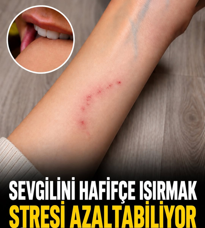 Sevgilinizi ısırır mısınız :D?