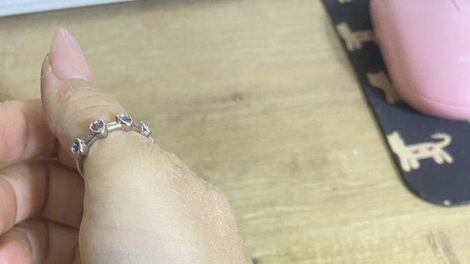 Üç krem denememe rağmen sürekli tekrarlayan egzama nasıl geçer?