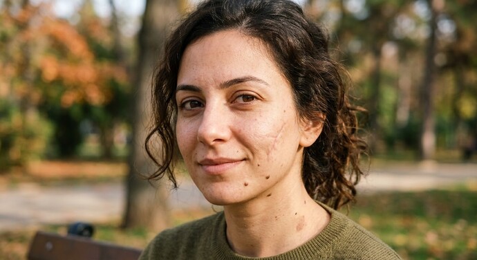 Vücudunuzda veya yüzünüzde dikiş izi, ben ya da doğum lekesi gibi şeyler var mı?